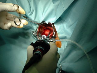 myomaderivery0051.jpg