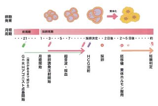 排卵誘発法.jpg